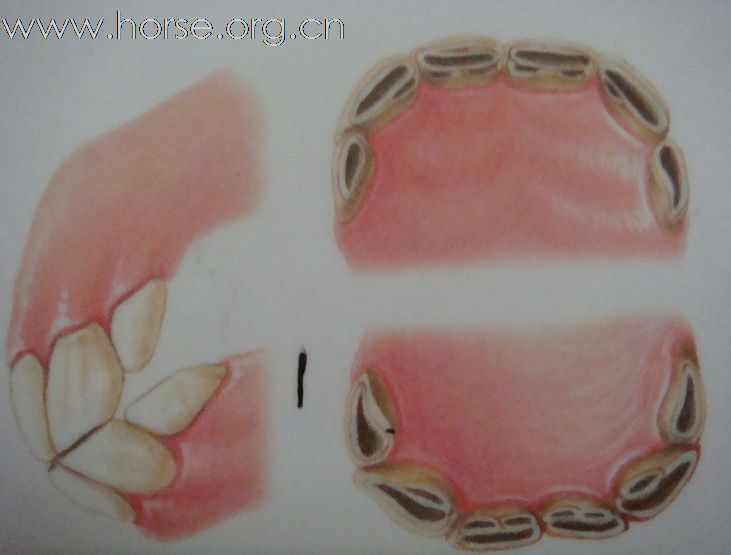 观牙齿辨马龄图片一览（1—3岁）