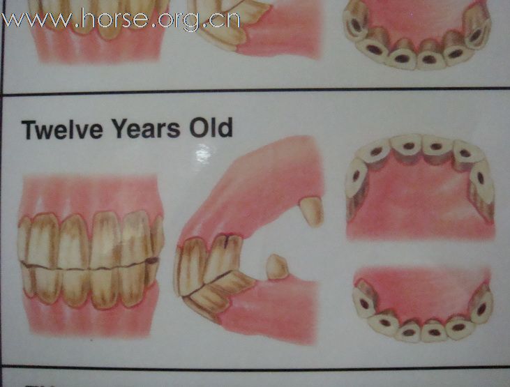 观牙齿辨马龄图片一览（8—12岁）