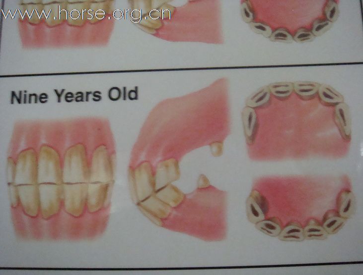 观牙齿辨马龄图片一览（8—12岁）