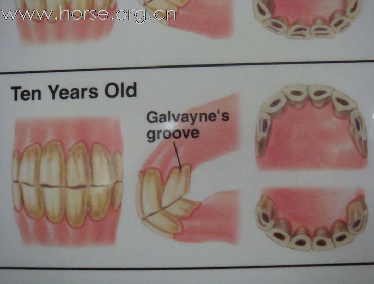 观牙齿辨马龄图片一览（8—12岁）